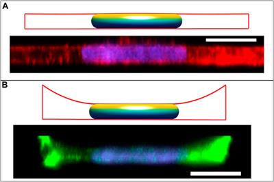 Nuclear shapes are geometrically determined by the excess surface area of the nuclear lamina